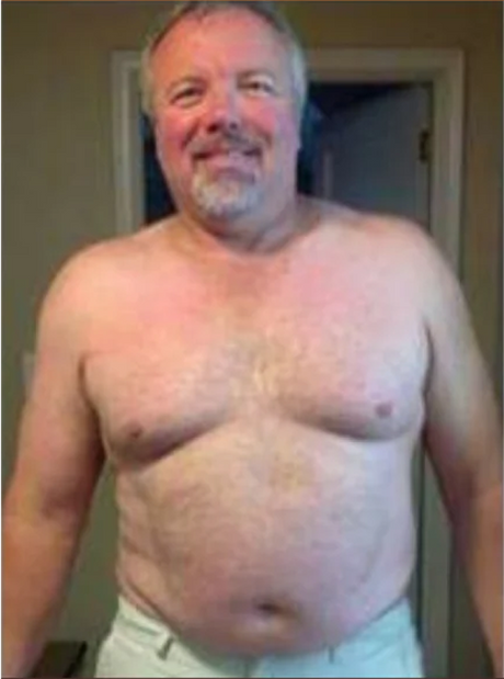 Mark, 46 — before