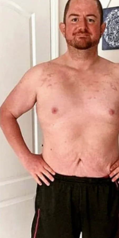 Steve, 44 — after