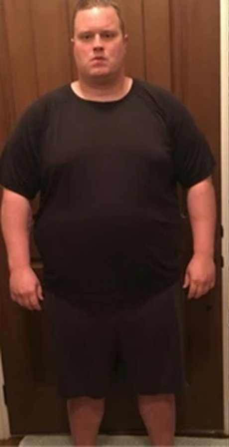 Rob, 40 — before